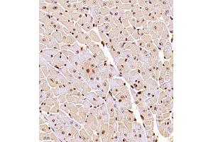 Immunohistochemistry of paraffin embedded mouse heart using RBAK (ABIN7075383) at dilution of 1:1000 (400x lens) (RBAK anticorps)