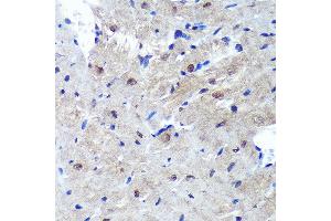 Immunohistochemistry of paraffin-embedded Mouse heart using PSME4 Rabbit pAb  at dilution of 1:100 (40x lens). (PSME4 anticorps  (AA 1634-1843))