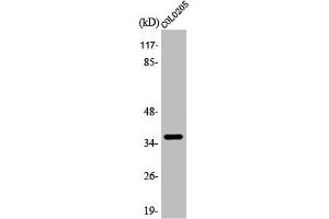 Western Blot analysis of COLO205 cells using Apaf-1-ALT Polyclonal Antibody (APAF1 anticorps  (C-Term))