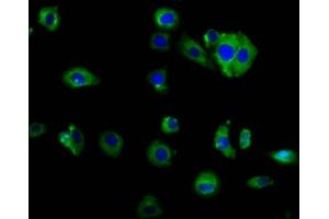 Immunofluorescence staining of HepG2 cells with ABIN7160065 at 1:166, counter-stained with DAPI. (MAP4K2 anticorps  (AA 386-469))