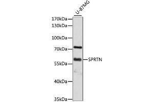 Western blot analysis of extracts of U-87MG cells, using SPRTN antibody (ABIN4905286) at 1:3000 dilution. (Spartan anticorps)