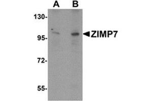 Western blot analysis of ZIMP7 in A20 cell lysate with ZIMP7 antibody at (A) 0. (ZMIZ2 anticorps  (Center))