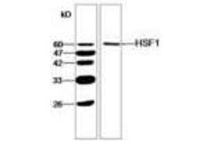 Image no. 1 for anti-Heat Shock Factor Protein 1 (HSF1) antibody (ABIN791450) (HSF1 anticorps)