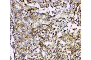 IHC analysis of Cyclophilin B using anti-Cyclophilin B antibody (ABIN6719475).