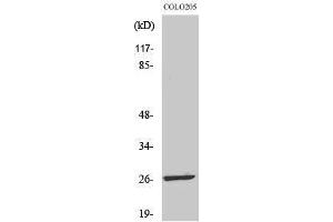 Western Blotting (WB) image for anti-Leucine Zipper, Down-Regulated in Cancer 1-Like (LDOC1L) (Internal Region) antibody (ABIN3175833) (LDOC1L anticorps  (Internal Region))