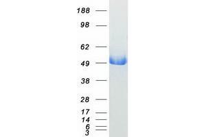 Validation with Western Blot