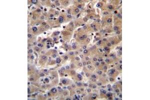 Immunohistochemistry analysis in formalin fixed and paraffin embedded human liver tissue reacted with Beta-glucuronidase Antibody (C-term) followed by peroxidase conjugation of the secondary antibody and DAB staining. (Glucuronidase beta anticorps  (C-Term))