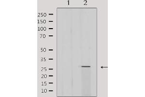 Western blot analysis of extracts from 293, using MRPL16 Antibody. (MRPL16 anticorps  (Internal Region))