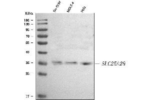 anti-Solute Carrier Family 25, Member 29 (SLC25A29) (AA 20-242) antibody