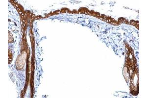 IHC-P Image 14-3-3 sigma antibody detects 14-3-3 sigma protein at cytosol on mouse skin by immunohistochemical analysis.