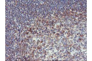 Image no. 11 for anti-phosphofructokinase, Platelet (PFKP) antibody (ABIN1500161)