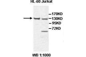 Western blot analysis of HL-60 and Jurkat cell lysate, using CHL1 antibody.