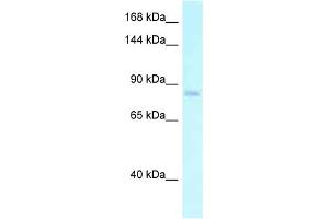 WB Suggested Anti-EMR2 Antibody Titration: 1. (EMR2 anticorps  (N-Term))