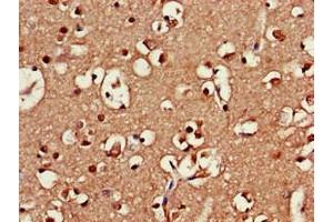 Immunohistochemistry of paraffin-embedded human brain tissue using ABIN7168941 at dilution of 1:100 (SRR anticorps  (AA 1-340))