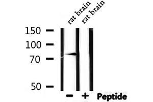 Western blot analysis of extracts from rat brain, using SCNN1B Antibody.
