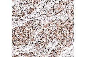 IHC analysis of DYNLT1 using anti-DYNLT1 antibody (ABIN5693148).