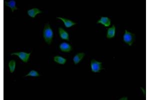 Immunofluorescence staining of A549 cells with ABIN7142109 at 1:50, counter-stained with DAPI.