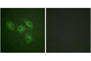 Immunofluorescence analysis of HeLa cells, using PI3-kinase p85-alpha (Ab-607) Antibody. (PIK3R1 anticorps  (AA 573-622))