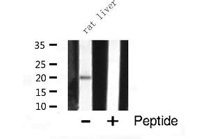Western blot analysis of JM4 expression in Rat liver lysate (PRAF2 anticorps  (C-Term))