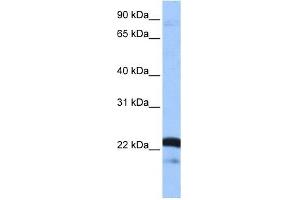 SFRS9 antibody used at 1 ug/ml to detect target protein. (SFRS9 anticorps  (Middle Region))