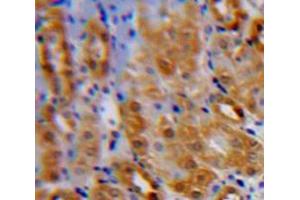 IHC-P analysis of Kidney tissue, with DAB staining. (IL1RL1 anticorps  (AA 162-349))