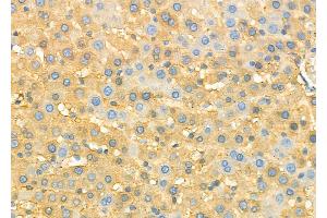 ABIN6260916 and ABIN6273211 at 1/100 staining Rat liver tissue by IHC-P.