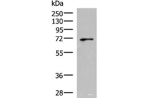 Western blot analysis of PC3 cell lysate using GSPT2 Polyclonal Antibody at dilution of 1:600 (GSPT2 anticorps)