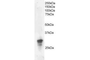 ABIN184670 staining (2µg/ml) of Jurkat lysate (RIPA buffer, 35µg total protein per lane). (GRB2 anticorps  (C-Term))
