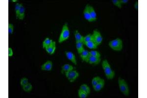 Immunofluorescence staining of HepG2 cells with ABIN7147549 at 1:100, counter-stained with DAPI. (CMKLR1 anticorps  (AA 321-373))