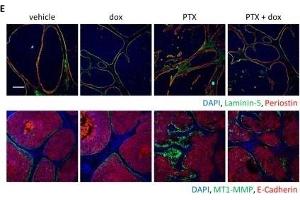 Knockdown of periostin inhibited mesenchymal cell proliferation and invasion, but did not affect apoptosis induction immediately after chemotherapy.
