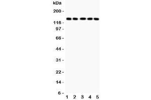 Western blot testing of Collagen Type 2 antibody and Lane 1:  COLO320;  2: HeLa;  3: MCF-7;  4: A549;  5: Jurkat lysate. (COL2A1 anticorps  (C-Term))