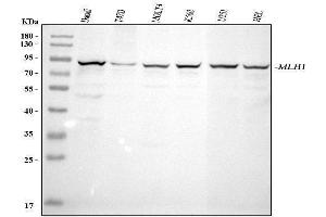 Western blot analysis of MLH1 using anti-MLH1 antibody (ABIN7599691).