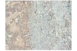 Image no. 1 for anti-Gastrointestinal Cancer Antigen CA19-9 (CA 19-9) antibody (ABIN1042585)