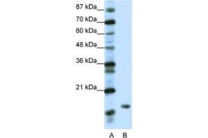 Western Blotting (WB) image for anti-TATA-Binding Protein-Associated Phosphoprotein (DR1) antibody (ABIN2461641) (DR1 anticorps)