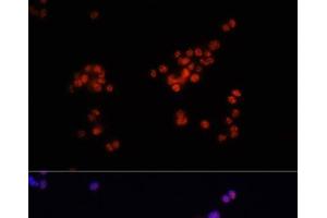 Immunofluorescence analysis of PC-12 cells using Phospho-Smad2(S465/467)/Smad3(S423/425) Polyclonal Antibody at dilution of 1:100.