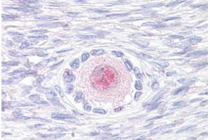 Anti-TM9SF4 antibody  ABIN1049415 IHC staining of human, ovary. (TM9SF4 anticorps  (Internal Region))