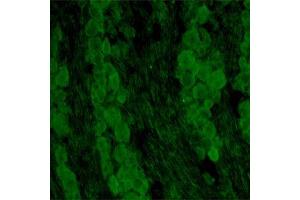 IF on rat DRG (postnatal day 7) at 40 µg/ml concentration using Sheep antibody to extracellular domain of TrkC (Trk-C, NTRK3, NT-3 growth factor receptor): IgG(ABIN351085).