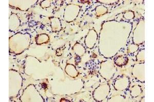Immunohistochemistry of paraffin-embedded human thyroid tissue using ABIN7146571 at dilution of 1:100 (Calreticulin anticorps  (AA 18-417))
