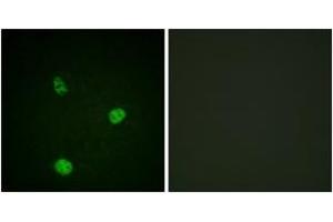 Immunofluorescence (IF) image for anti-Microphthalmia-Associated Transcription Factor (MITF) (AA 151-200) antibody (ABIN2888676) (MITF anticorps  (AA 151-200))