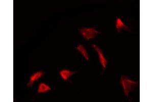 ABIN6267329 staining HuvEc by IF/ICC.