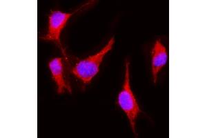 IF analysis of VEGF Receptor 2 using anti-VEGF Receptor 2 antibody (ABIN5693262). (VEGFR2/CD309 anticorps  (AA 20-244))