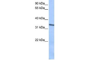 WB Suggested Anti-SEPT9(septin 9) Antibody Titration: 0. (Septin 9 anticorps  (C-Term))