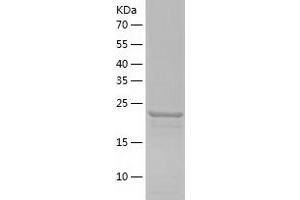 Western Blotting (WB) image for Exosome Component 5 (EXOSC5) (AA 1-235) protein (His-IF2DI Tag) (ABIN7122863)