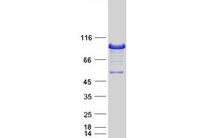 Validation with Western Blot