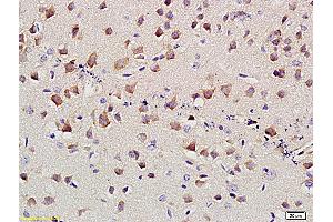 Formalin-fixed and paraffin embedded mouse brain labeled with Anti-SLC4A4 Polyclonal Antibody, Unconjugated (ABIN677498) at 1:400 followed by conjugation to the secondary antibody and DAB staining (kNBC (AA 1-100) anticorps)