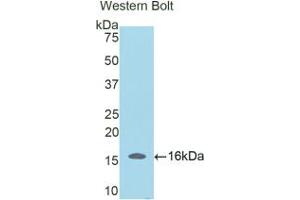 Western blot analysis of the recombinant protein. (SFRP5 anticorps  (AA 181-303))