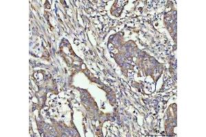 anti-Colony Stimulating Factor 3 (Granulocyte) (CSF3) (AA 38-207) antibody