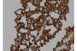 ABIN6276542 at 1/100 staining Mouse lung tissue by IHC-P.