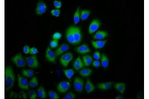Immunofluorescence staining of Hela cells with ABIN7172863 at 1:133, counter-stained with DAPI. (TRPM3 anticorps  (AA 1606-1713))