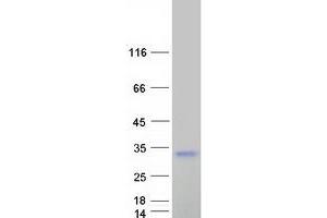 Validation with Western Blot